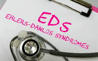 this image depicts Ellers-Danlos Syndrome, a genetic disorder affecting connective tissue.