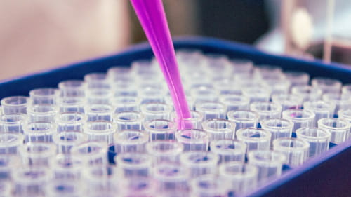 Lab technician using a pipette.
